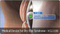 Medical Device for Dry Eye Syndrome - KCL1100
